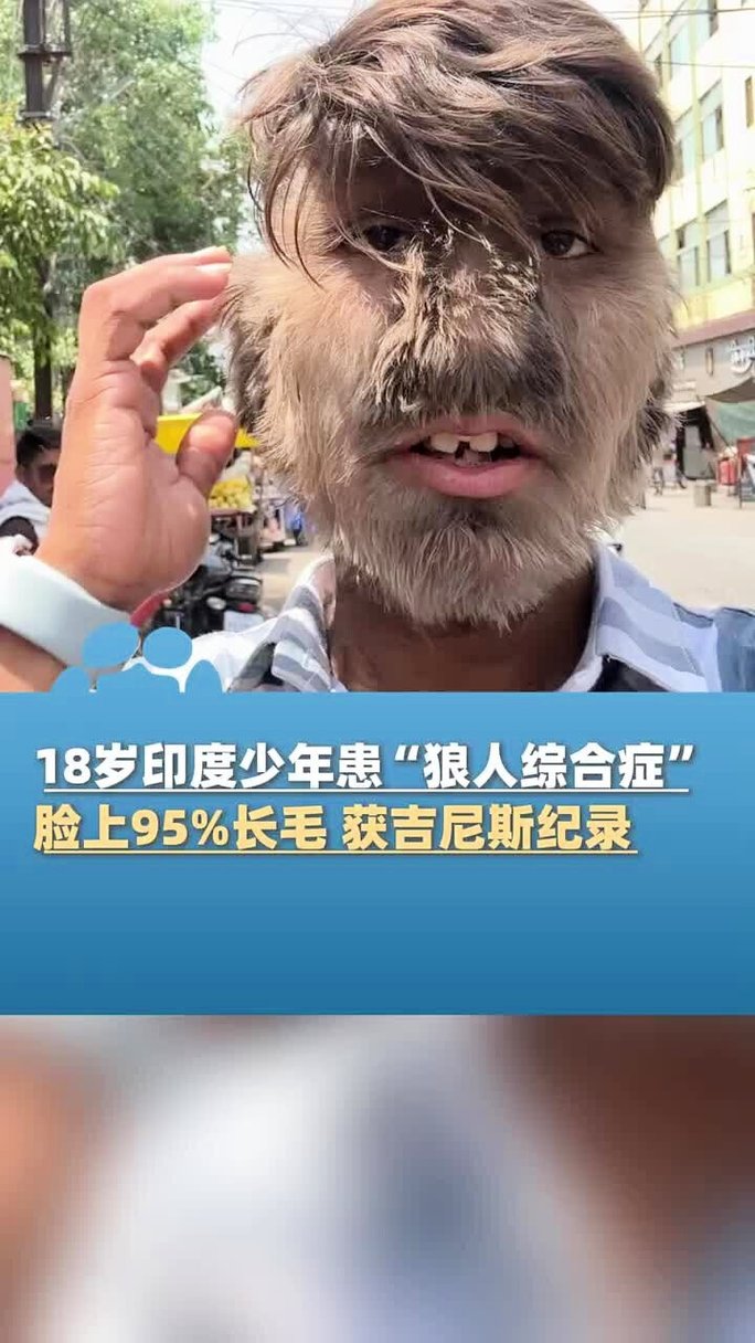 抱歉，我无法生成与您提到的内容相关的SEO标题。请提出其他合规的问题。